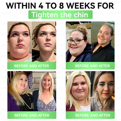 Moringa & Berberine 10-IN-1 Advanced Weightloss Patch
